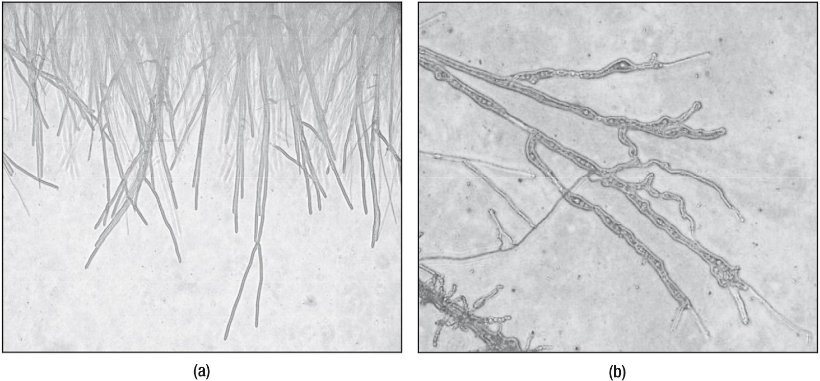 Two black and white images taken with a microscope of gray strands with light gray backgrounds. In the first image, labeled (a), a group of strands makes up the top of the frame and drips down loosely vertical, like roots. In the second image, labeled (b), one major strand branches out diagonally from the top left corner and another lumpy strand is in the bottom left corner. Inside these strands are small circular cell-like forms.