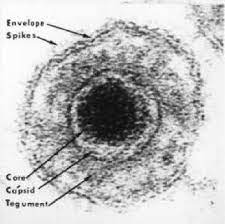 A blurry microscope image of a virus particle with different parts labeled with arrows “Envelope”, “Spikes”, “Core”, “Capsid”, “Tegument”. The cell-like shape has a dark center surrounded by shaded rings.
