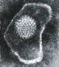A microscope image of a herpes simplex virus particle with a white center and white outer irregular oval ring. The center circle looks like the center of a daisy with small particles coming together in the larger white circle.