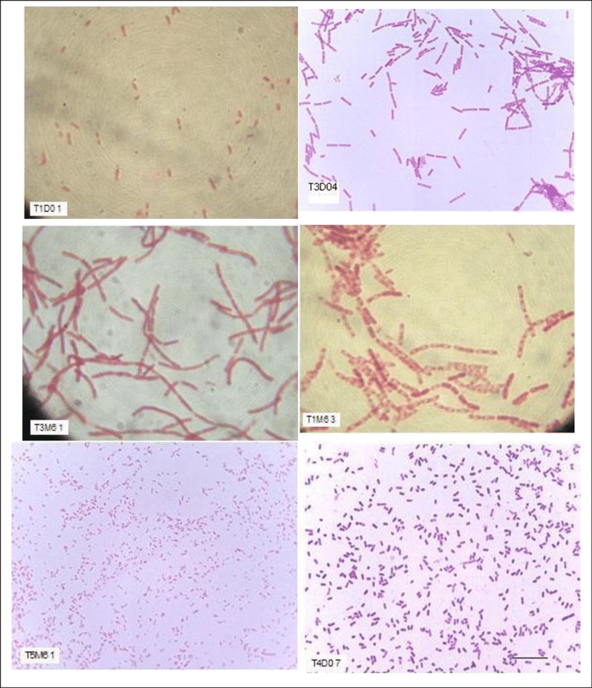 6 microscope images of nitrogen-fixed bacteria arranged vertically 2x3, magnified 1000x. The bacteria are red-pink strands and ovals on pink and yellowish backgrounds.