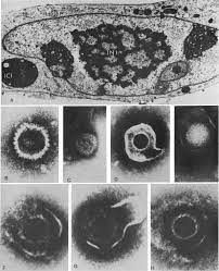 An arrangement of 8 small microscope images. The largest image on the top has a map-like quality of 4 dark blobs with light gray blobs inside on a light gray background surrounded by a loose dark ring. The other 7 images show black and gray circles with dark centers, one with a light center and black background, some of the circles have more defined outer rings and some appear as if the dark centers are leaking out of and bursting the outer rings.