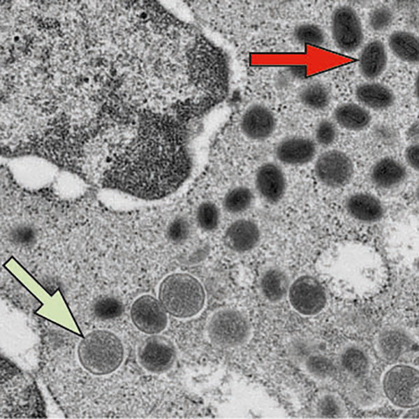 An image of electron microscopy of the monkeypox virus. Several small dark ovals cluster in the top right of the image, an added red arrow points to one. At the bottom left a light green arrow points to lighter gray circles surrounded by a few dark ovals. 