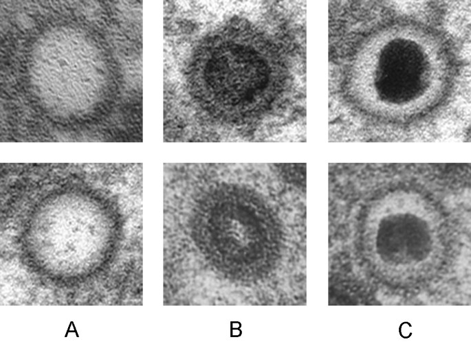 6 microscopic images arranged 3x2. The first 2 images labeled 'A' depict light gray circles with dark outer rings on gray backgrounds, the second 2 images labeled 'B' depict dark gray circles with black centers and dark outer rings on gray backgrounds, and the third 2 images labeled 'C' depict light gray circles with black centers and dark outer rings on gray backgrounds.