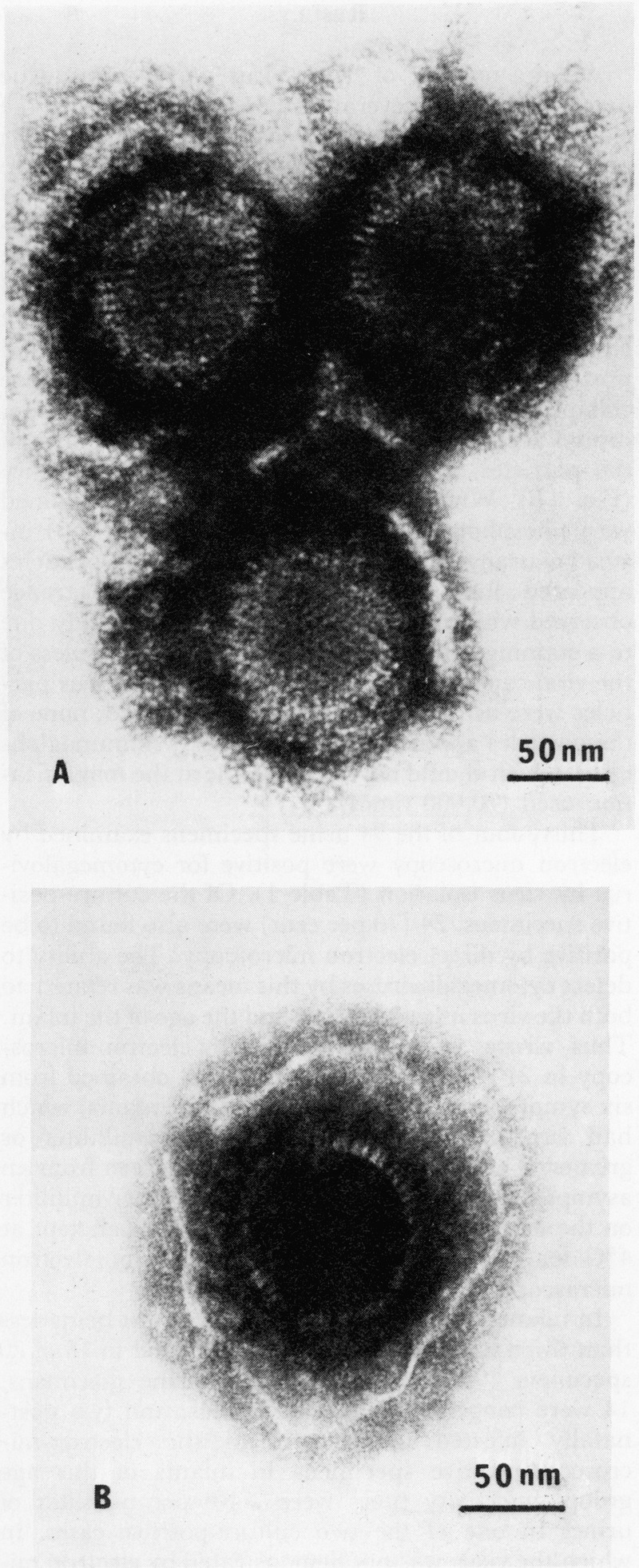 2 microscopic images arranged vertically. The top image is labeled 'A' and shows a downward facing triangular cluster of 3 black dissolving circles with lighter rings delineating slightly lighter dark gray centers. The bottom image is labeled 'B' and shows a single dissolving circle with a black center and a burst light outer surrounded by a gray aura of material that appears to be leaking from the center.