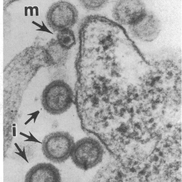 Electron micrograph of cell labeled with arrows immature (i) and mature (m). HIV-like particles 24 hours after cells were infected with recombinant vaccinia virus. Several circular particles interact among larger forms.