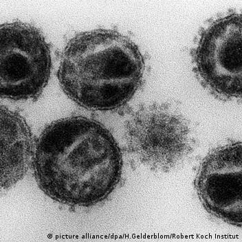An electron Micrograph of 6 HIV particles, dark circles with irregularities inside on a light gray background.